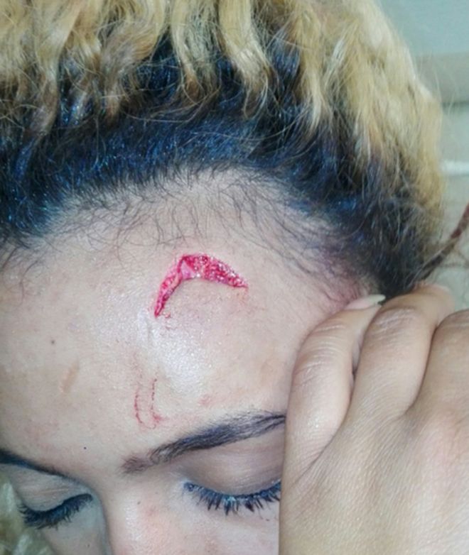 Woman allegedly assaulted by Grace Mugabe