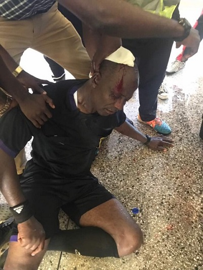 Referee Liman was allegedly beaten by fans of Elmina Sharks during a Ghana Premier League game