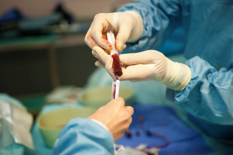 Ghana records first-ever bone marrow transplant procedure