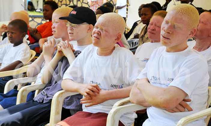 Six albino candidates to run for Malawi elections