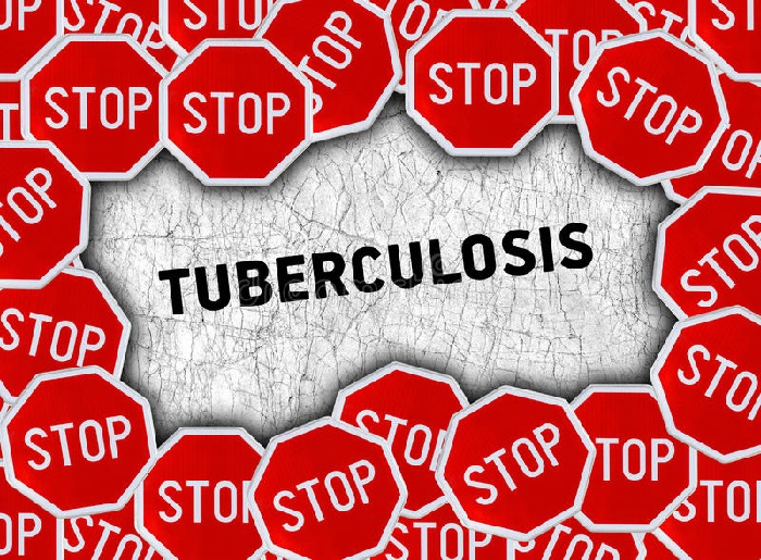 stop_Tuberculosis 