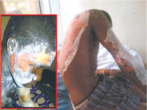 Mother pleaded not guilty for pouring hot water on son over GHS1