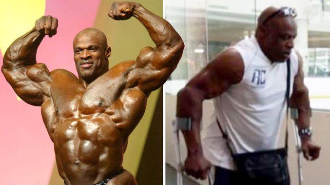 Bodybuilding legend now crippled