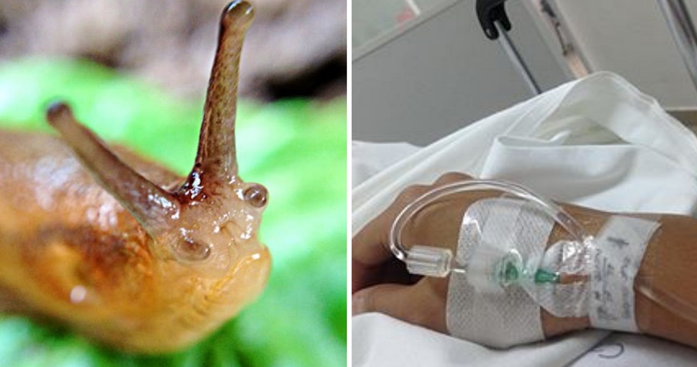 Teenager dared by friends to eat slug, becomes paralysed & dies 8 years later