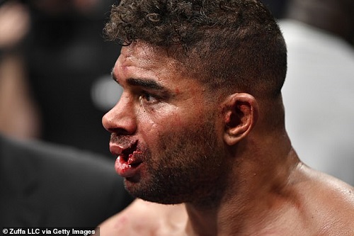 Alistair Overeem