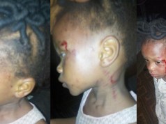 2-year-old girl brutalized for not being about to count 1 to 200