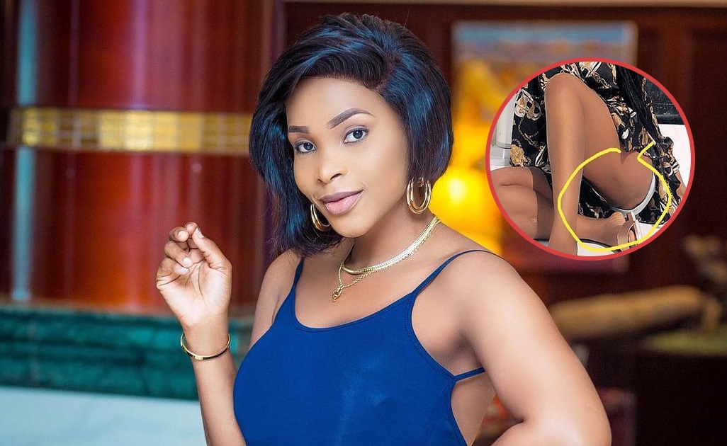 PIC: Benedicta Gafah’s Rashes Botors Exposed On Social Media