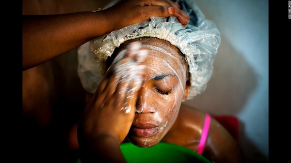 Rwanda Rwanda imposes countrywide ban on skin bleaching productsimposes countrywide ban on skin bleaching products