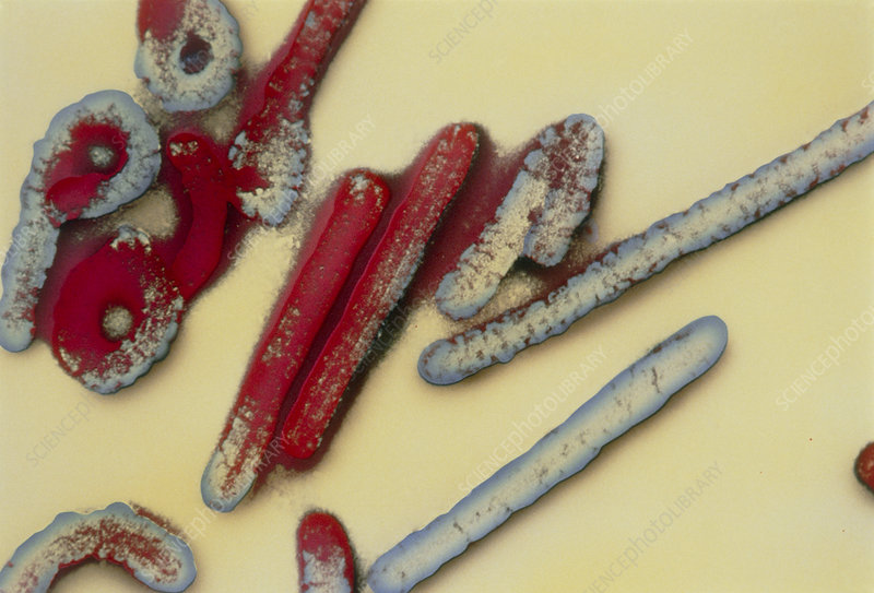 GHS issues alert about possible entry of Marburg virus Prime News Ghana