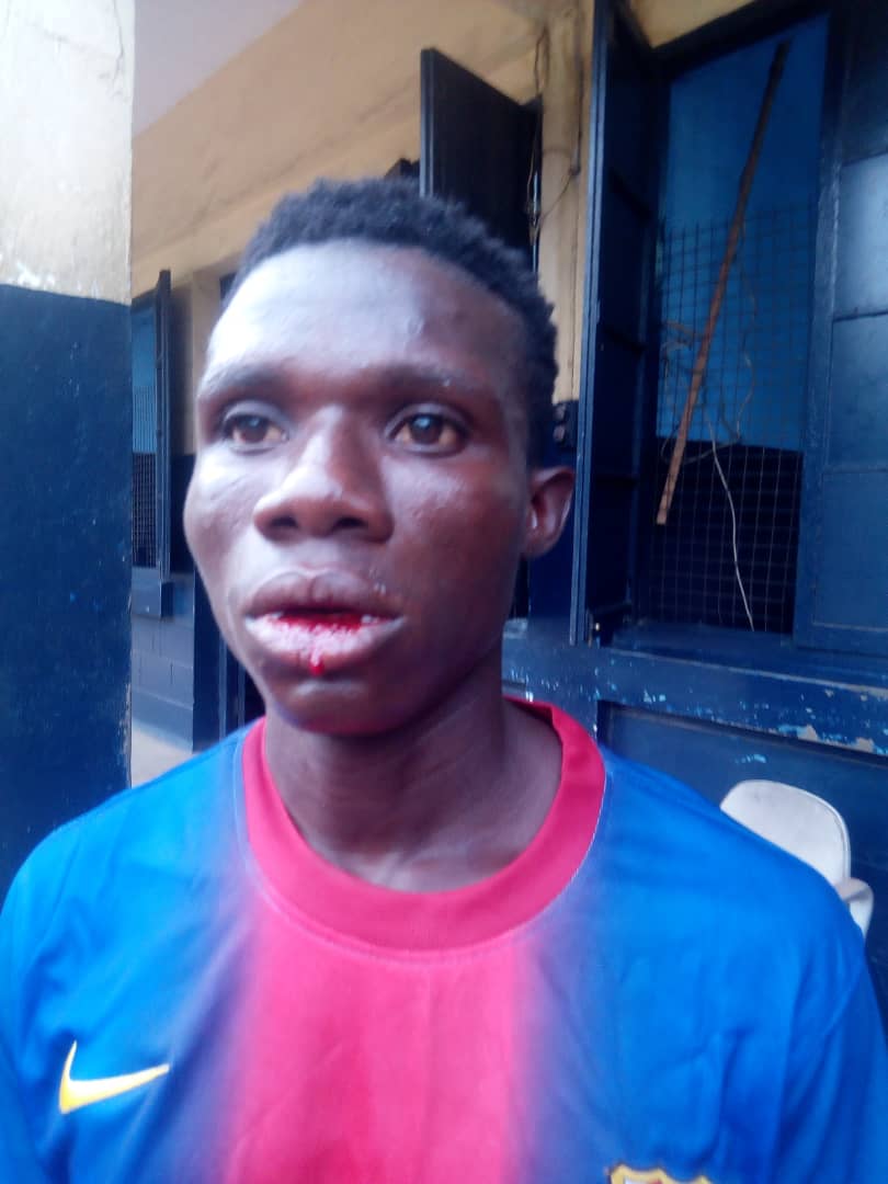 Sylvester Ayitey-Adjin after the assault 