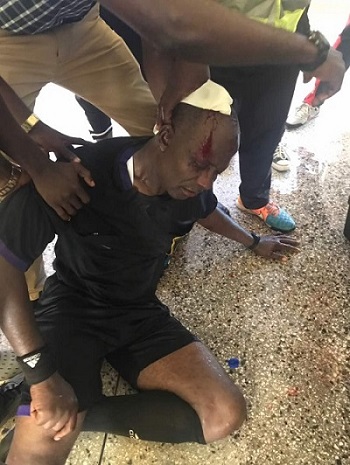 Referee Nuhu Liman is reported to have been attacked by Elmina Sharks fans